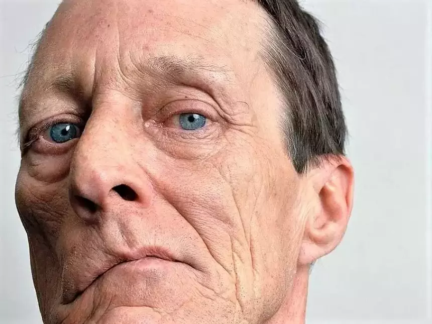 Риск инфаркта и инсульта научились определять по сетчатке глаза