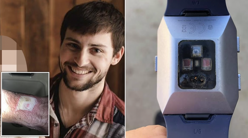 Обама все еще носит отозванные из-за риска ожогов Fitbit Ionic