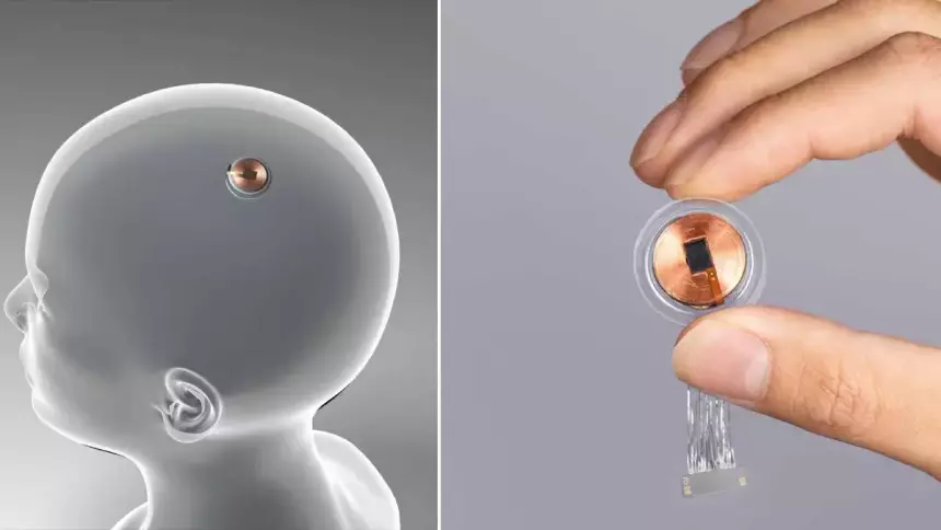 Имплантируемый в мозг компьютер Neuralink испытают на людях в течении полугода