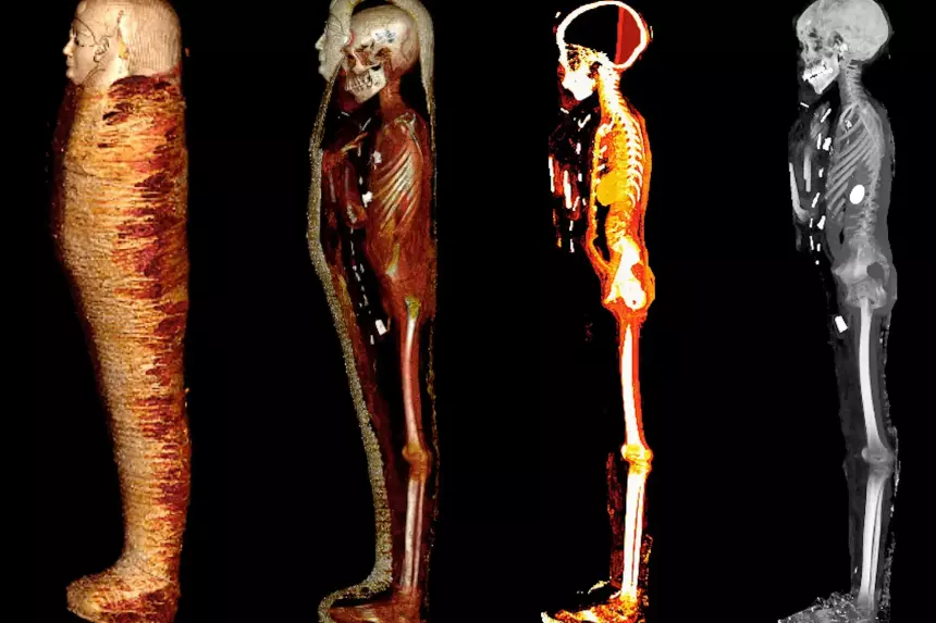 Томография выявила защитный амулет на половом органе 2 300-летней мумии