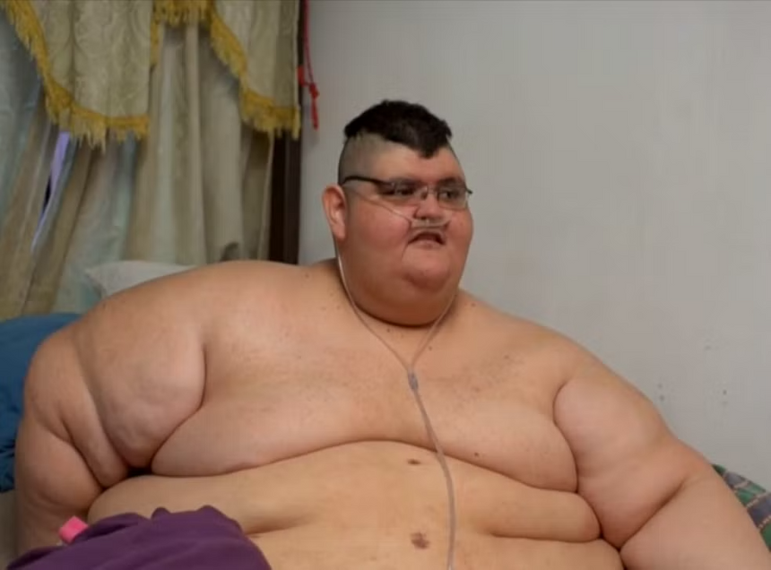 Операция по снижению веса оказалась полезна для защиты от появления рака и диабета