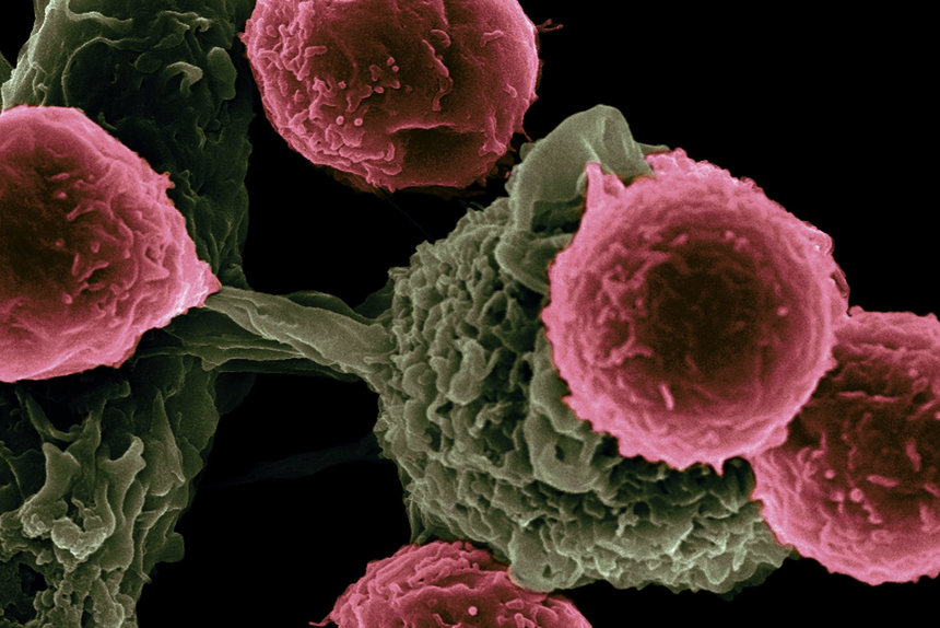 Рак научились лечить при помощи молекулярного якоря