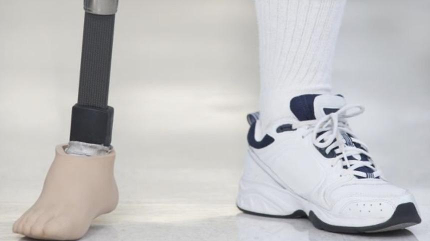 В России создали протез ноги, избавляющий от фантомных болей