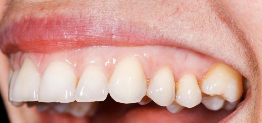 Правда ли, что заболевания полости рта ведут к артриту