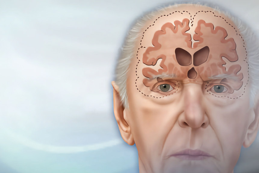 Откажитесь от этих двух вредных привычек и риск старческого слабоумия уменьшится на 90%