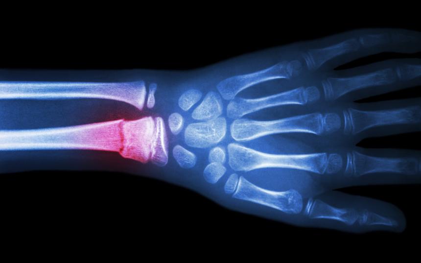 Российские учёные открыли способ заживлять кости... холодом