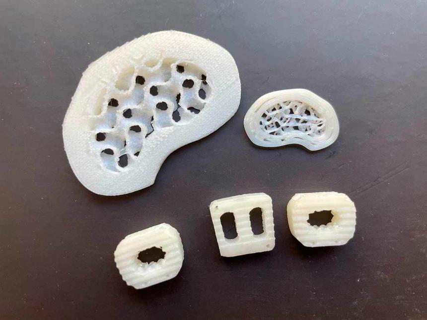 Новый российский протез предотвратит развитие грыж и остеохондроза