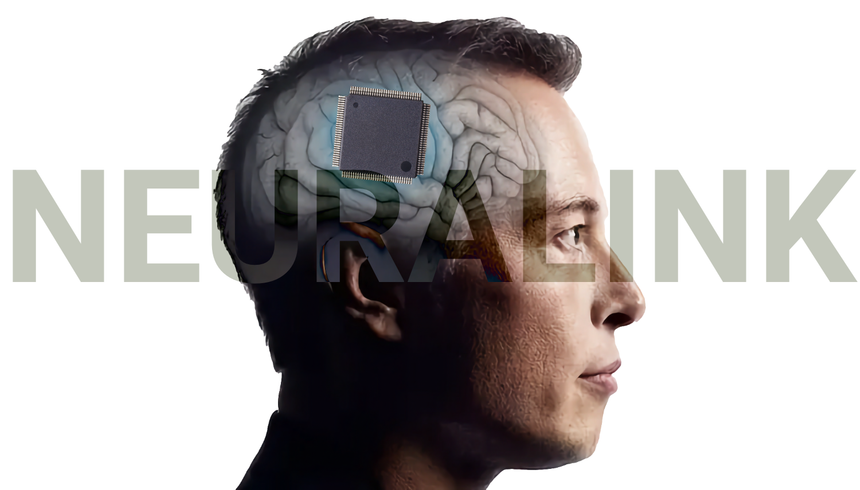 Ученые прокомментировали первое испытание нейрочипа Илона Маска