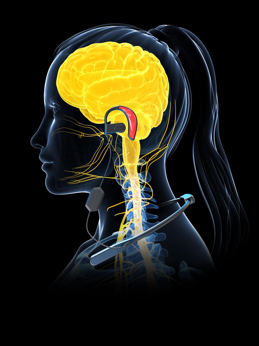 Российская компания Neiry создала наушники для излечения от психических расстройств