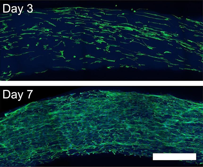 Созданы нановолокна для выращивания тканей вне тела