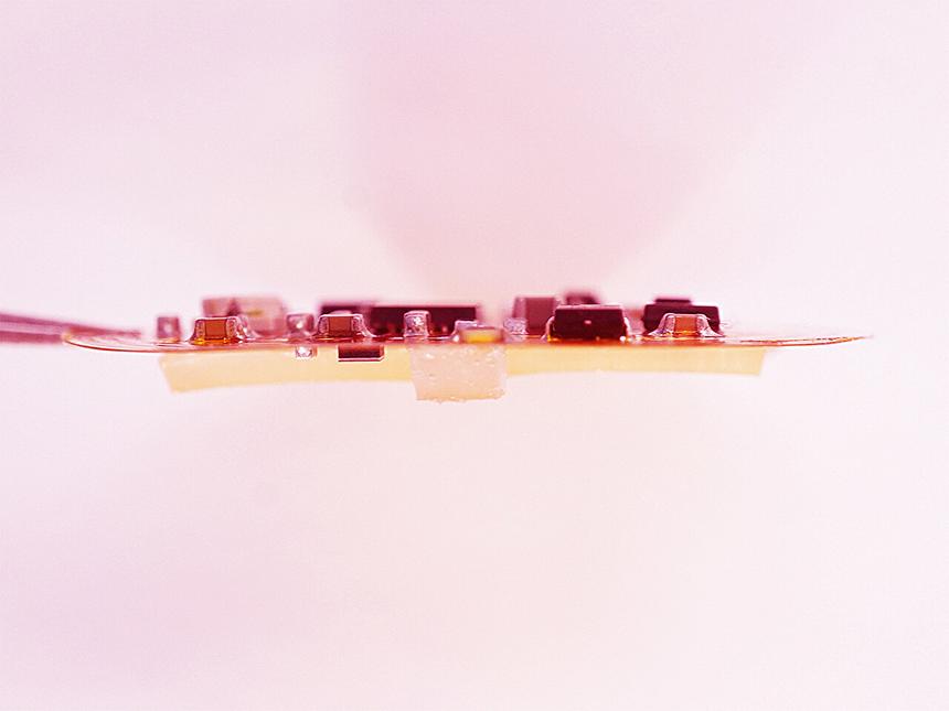 Ученые создали «живую биоэлектронику» для лечения кожных заболеваний