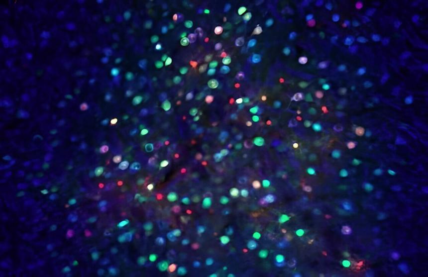 Ученые разработали новый метод генной терапии мозга