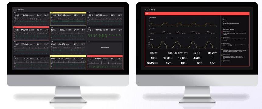 Ростех завершил испытания первой отечественной ЦМС для реанимации пациентов