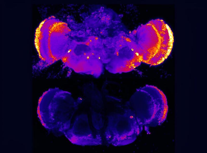 Ученые обнаружили новый способ лечения болезни Альцгеймера