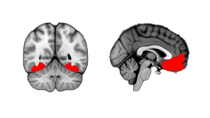 Ученые определили участок мозга, отвечающий за любопытства
