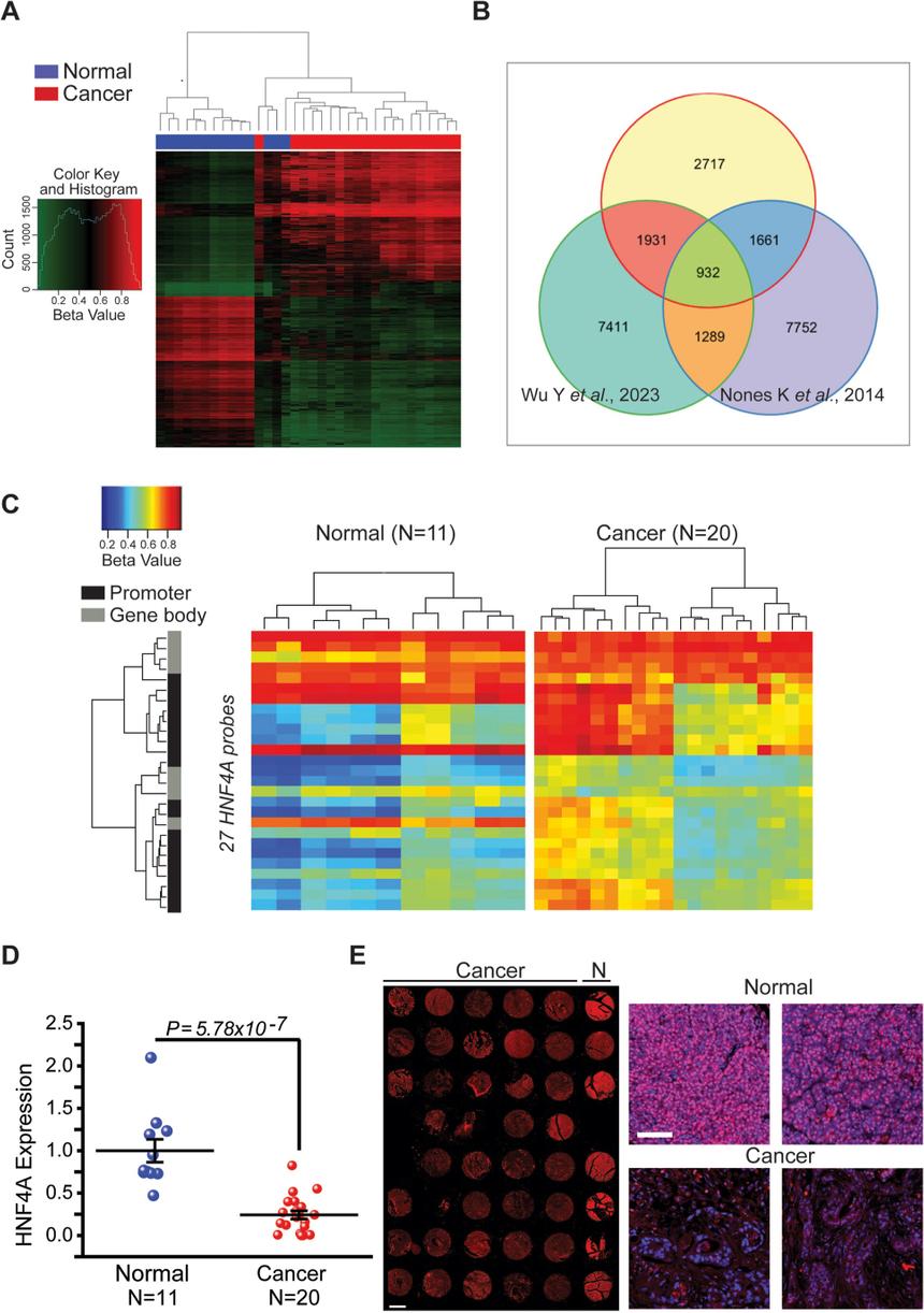 Ученые выявили «выключатель» рака поджелудочной железы
