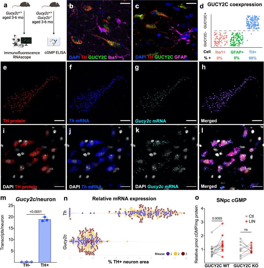 Ученые нашли способ защитить мозг от болезни Паркинсона
