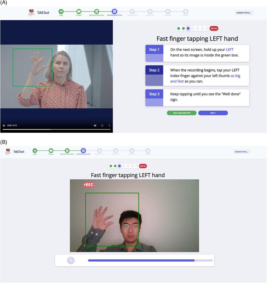 Тест на основе компьютерного зрения поможет предсказать деменцию