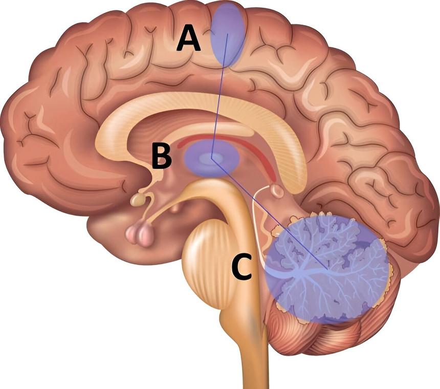 Исследование выявило генетические причины тремора рук