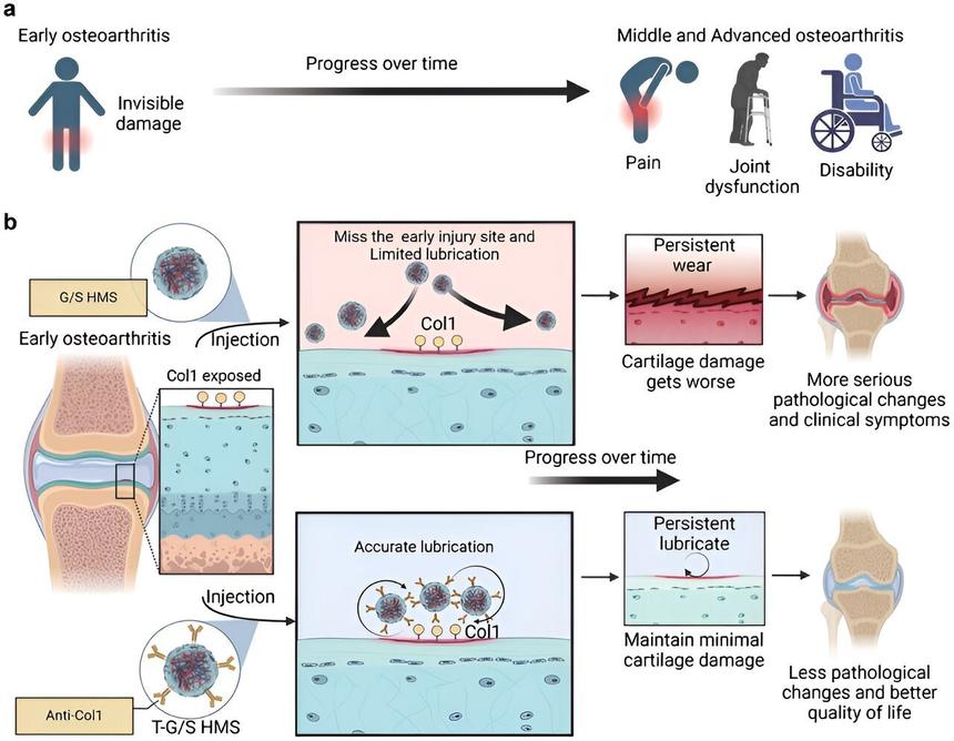 Новый гидрогель поможет в лечении остеоартрита