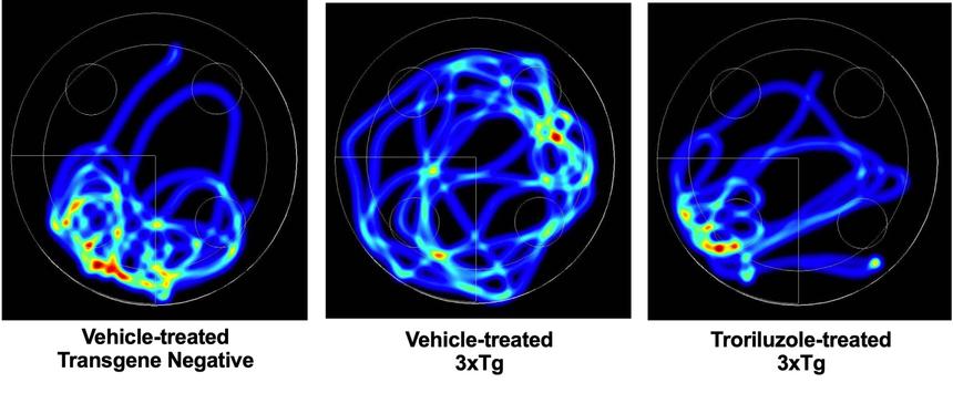 Новый препарат замедлит развитие болезни Альцгеймера