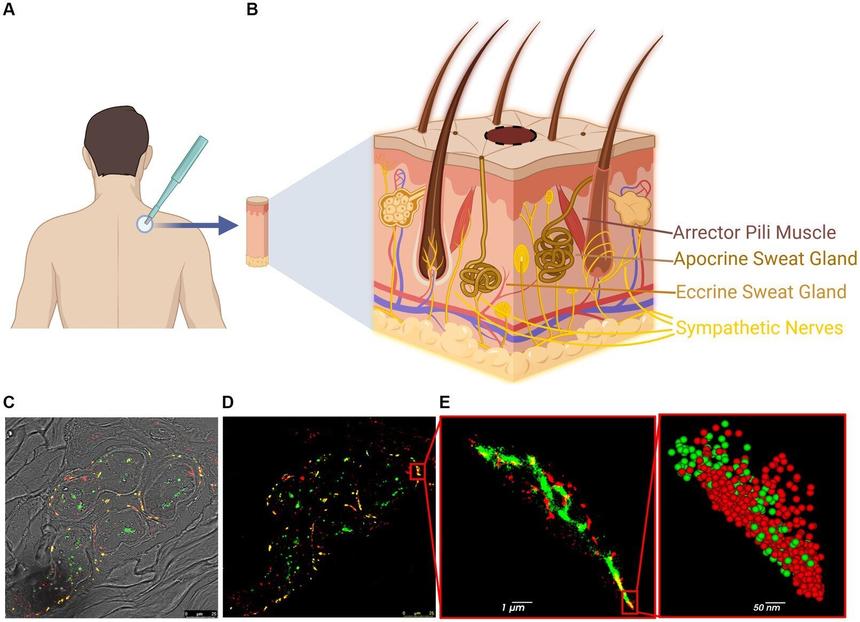 Новая технология поможет обнаружить болезнь Паркинсона на 20 лет раньше