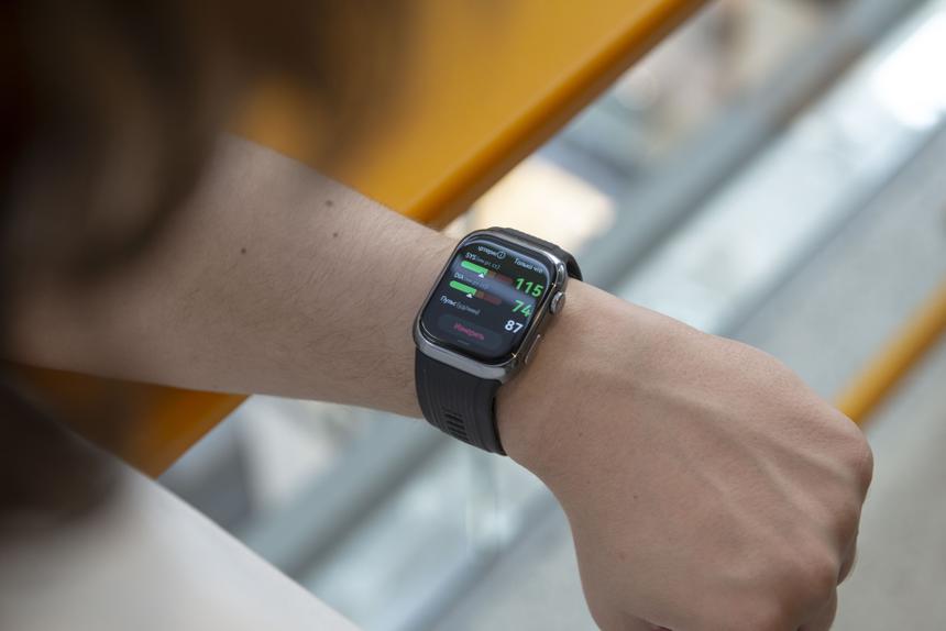 Умные часы с круглосуточным измерением артериального давления