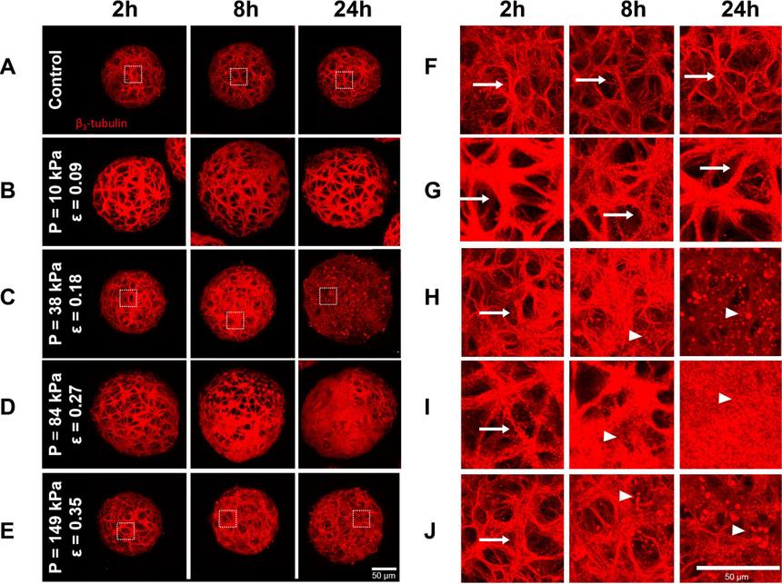 Ученые разработали «мини-мозги» для изучения черепно-мозговых травм