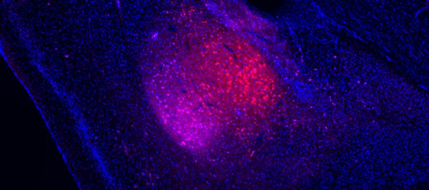 Ученые нашли причину «негативного восприятия» мира при депрессии
