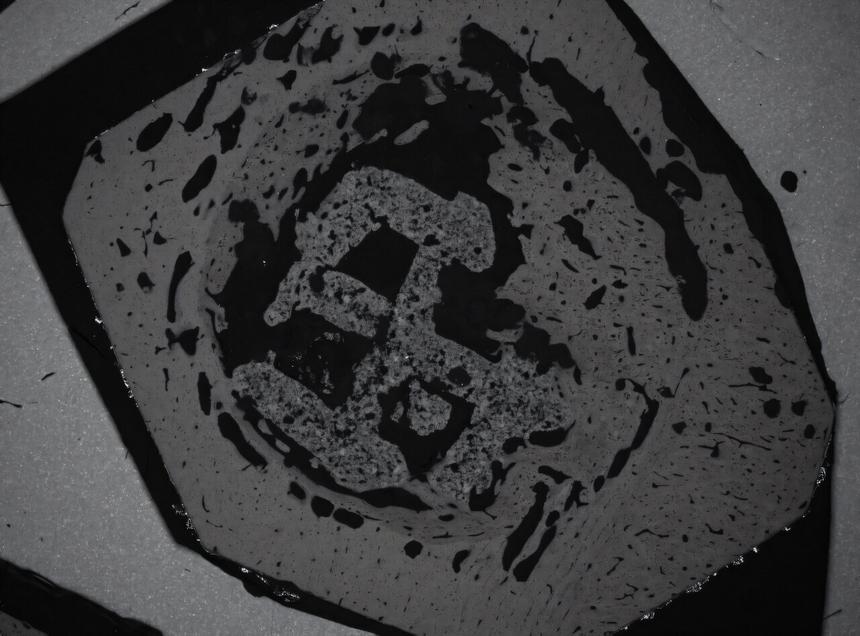 Ученые создали растворяющийся костный имплантат для быстрого заживления