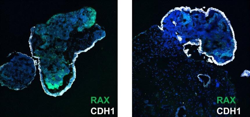ИИ предсказал развитие «мини-органов» точнее людей