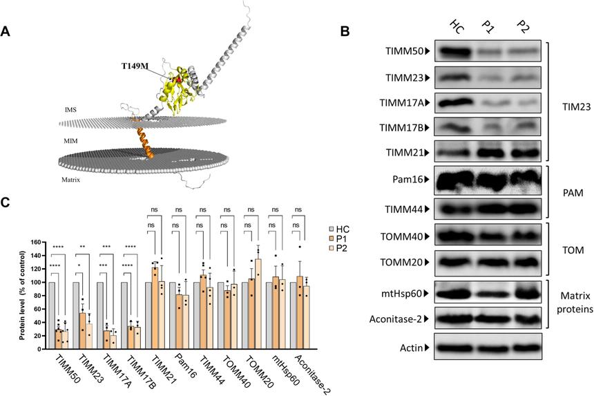 Расшифрован механизм редкого неврологического заболевания