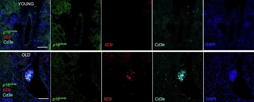 Ученые нашли новый биомаркер старения клеток