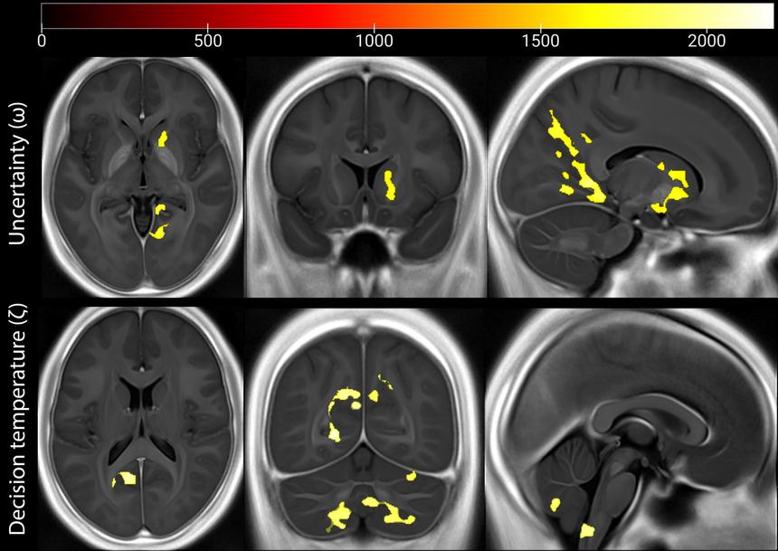 Исследование показало, что неизвестность делает боль острее