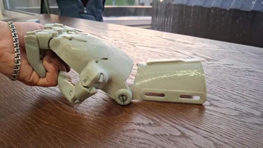 В России создали доступный протез кисти с индивидуальной настройкой