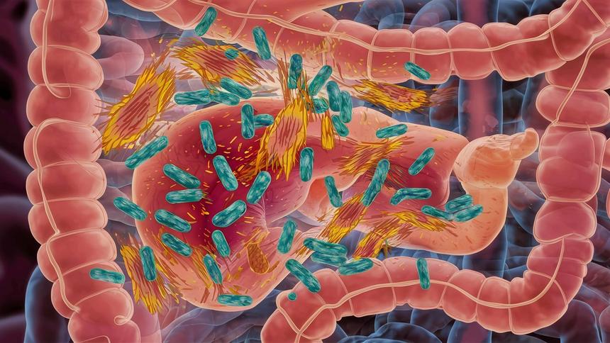 Пересадка кала помогла в борьбе с алкогольной зависимостью