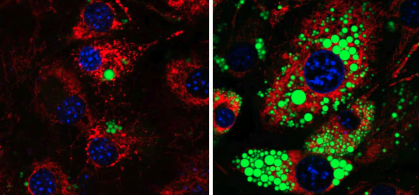 Ученые нашли способ блокировать накопление жира без потери мышц