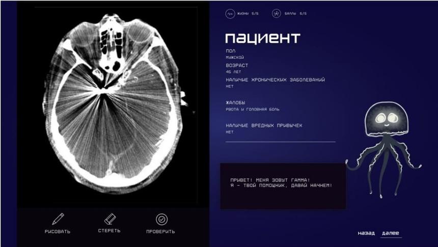 Российские студенты создали симулятор для обучения будущих врачей-рентгенологов