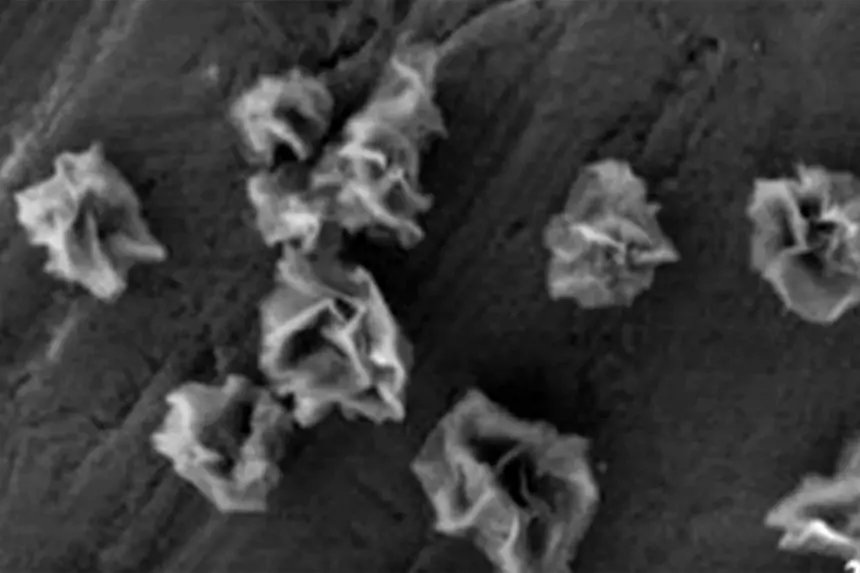 Созданы металлические «наноцветы» для лечения мозга