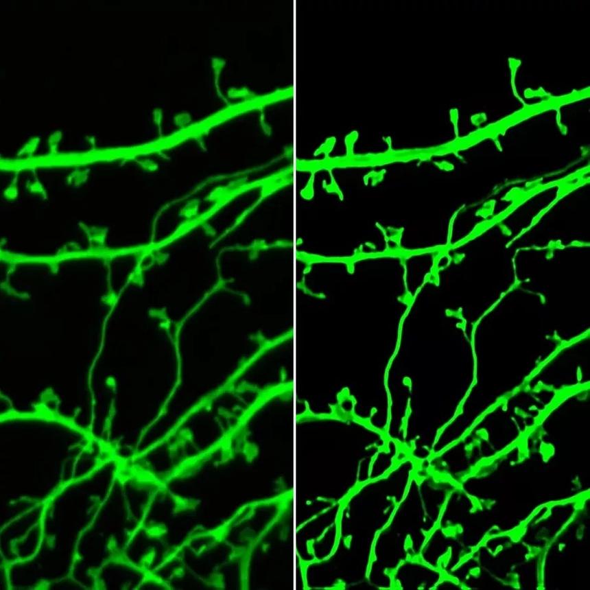 В России изобрели метод улучшения разрешения для микроскопов с помощью ИИ