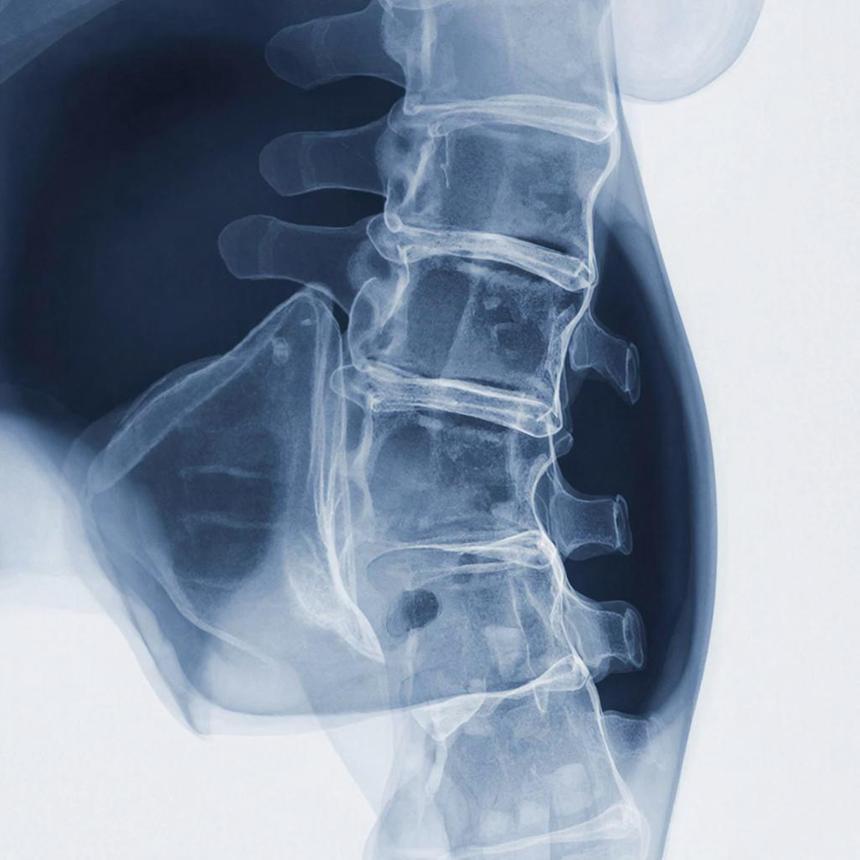 Учёные использовали жировую ткань для восстановления костей