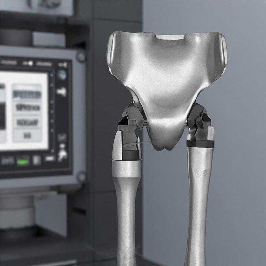 В России создали программу для 3D-печати тазобедренных протезов из двух металлов