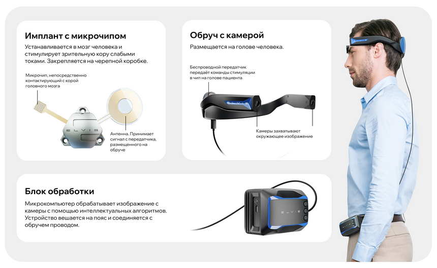 Микроамперы против слепоты в первом российском нейроимпланте ELVIS